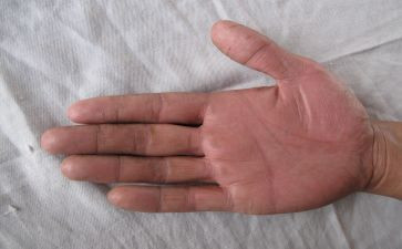 手掌树中班教案8篇